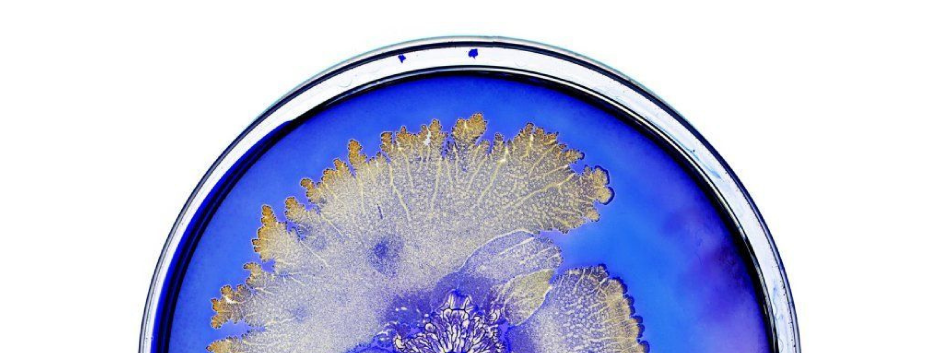 What Is Biofilm and Why It's the Hidden Threat to Your Oral Health